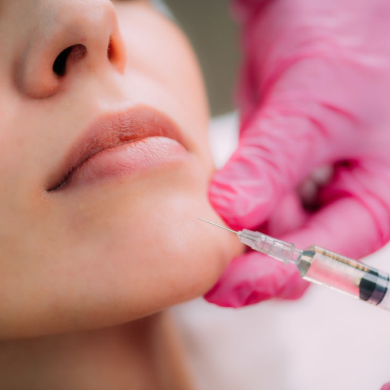 Dermal Fillers