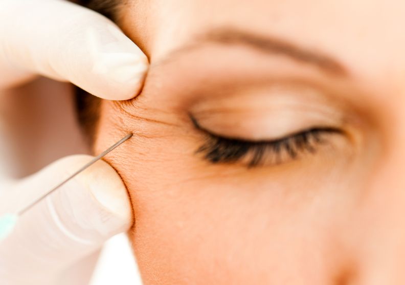 Botox for Crow's Feet