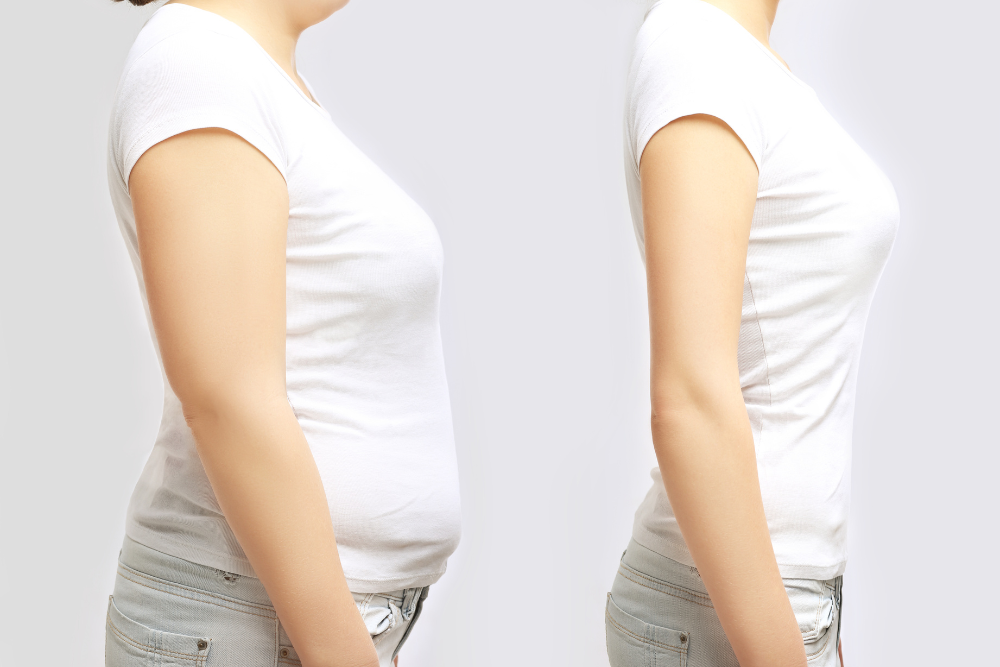 #1 Weight Loss Injections Near Baltimore Maryland