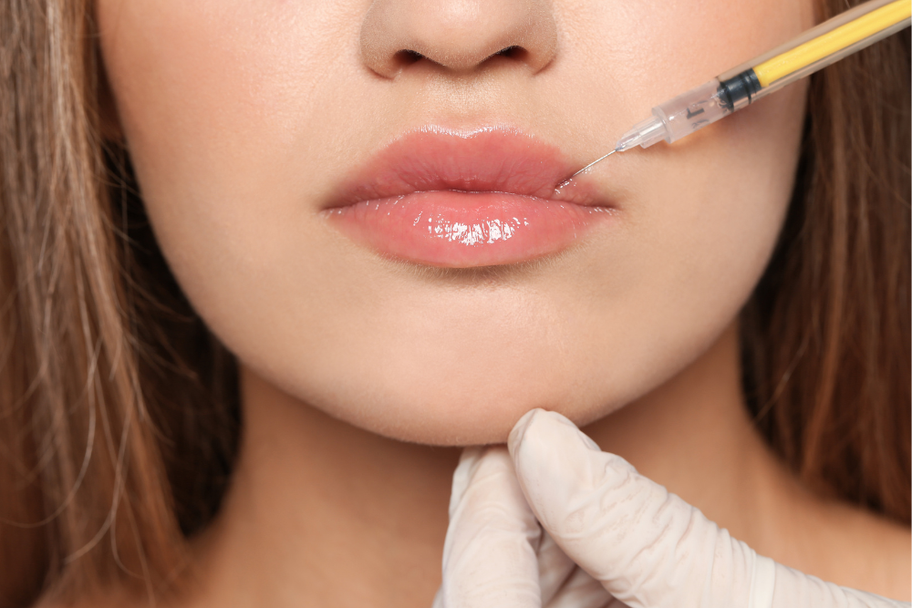 Same-Day Lip Filler in Towson, Maryland