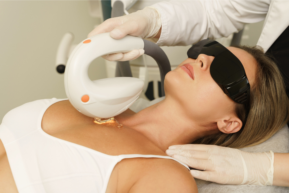 Best BBL Laser Treatment in Howard County, MD