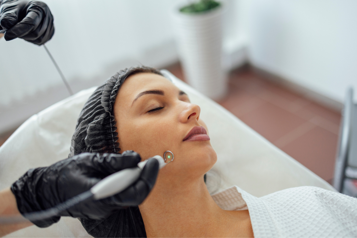 CO2 laser resurfacing for acne scars in Columbia MD