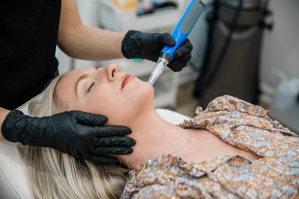 woman at one of the top-rated microneedling clinics