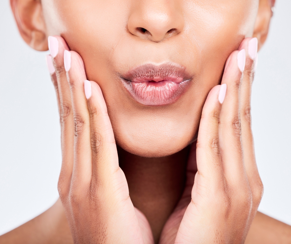 woman who achieved the perfect pout with lip filler in Columbia